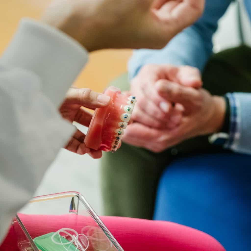 3M Advanced Braces Alexandria, VA Larson Orthodontics