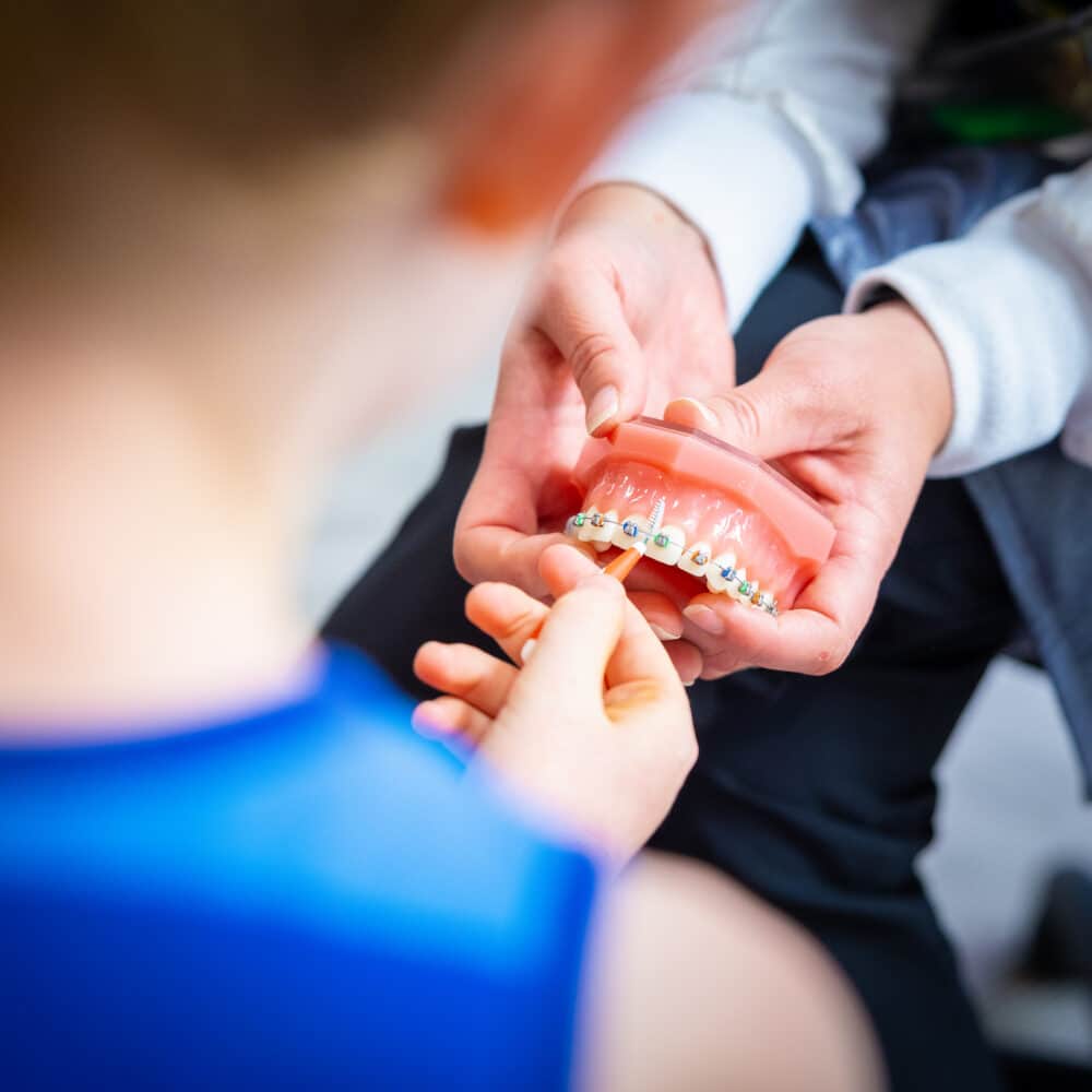 3M Advanced Braces Alexandria, VA Larson Orthodontics