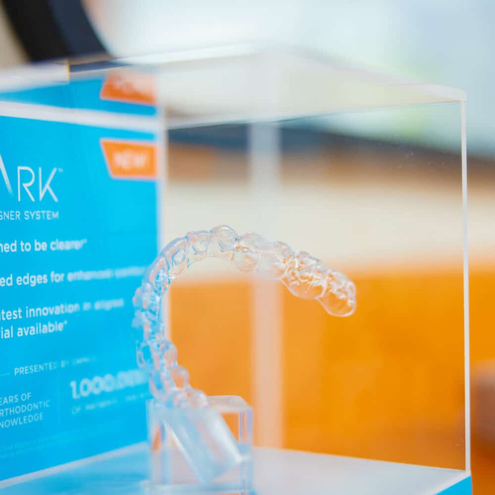 Spark Clear Aligners | Alexandria, VA | Larson Orthodontics