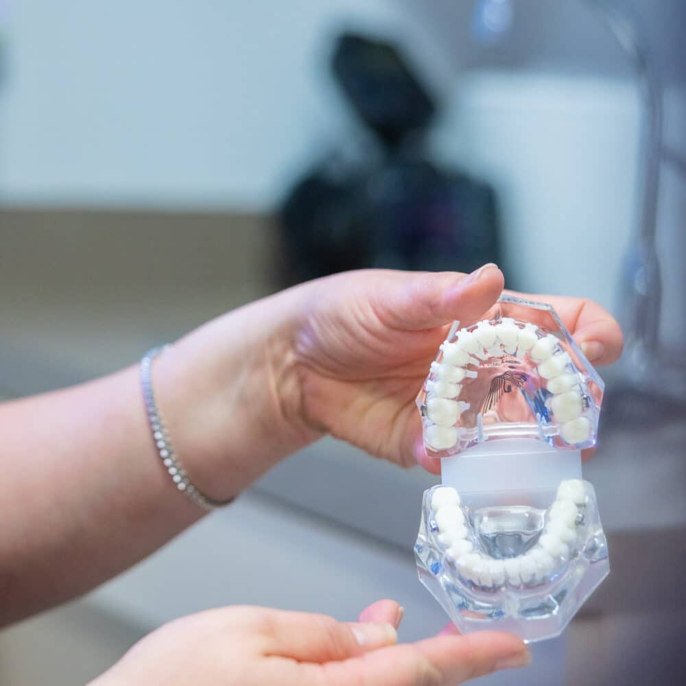 LightForce Braces Alexandria, VA Larson Orthodontics